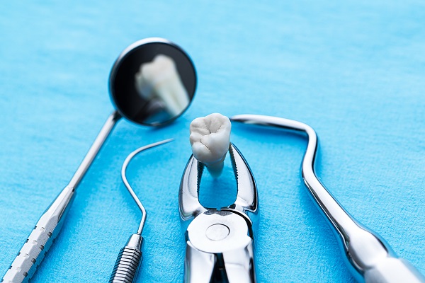 When A Dental Emergency May Require Tooth Extractions